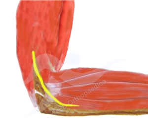 Physiotherapy cubital tunnel decompression leaflet